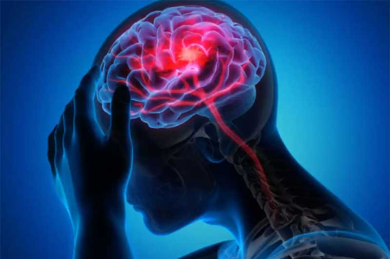 Neurological Disorders